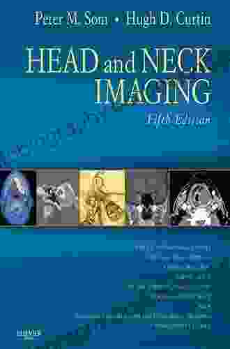Head And Neck Imaging: Expert Consult Online And Print